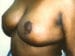 After Image