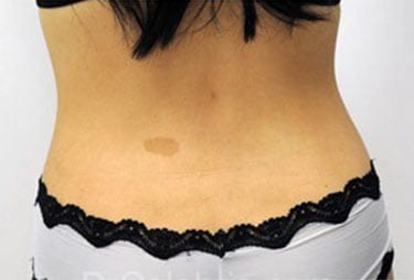 After Image