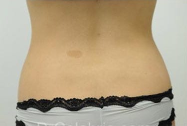 Before Image