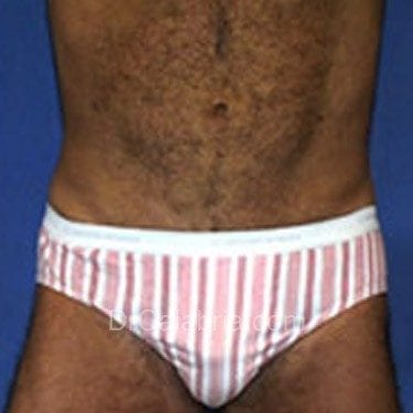 After Image