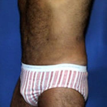 After Image