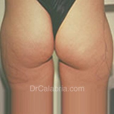 After Image