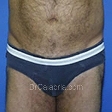 Before Image