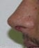 After Image