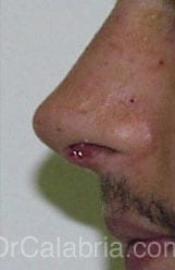 After Image