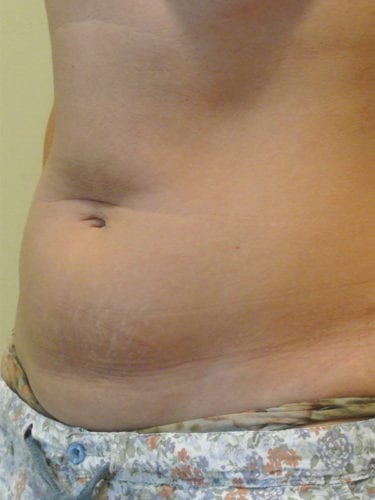 Before Image