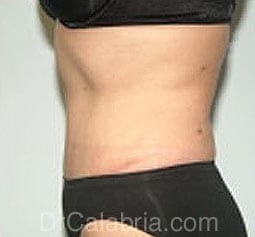 After Image