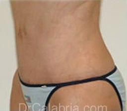 After Image