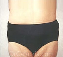 After Image