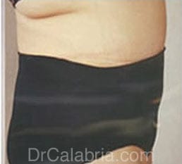 After Image