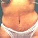 After Image