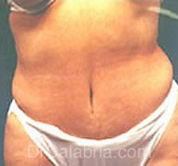 After Image