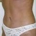 After Image