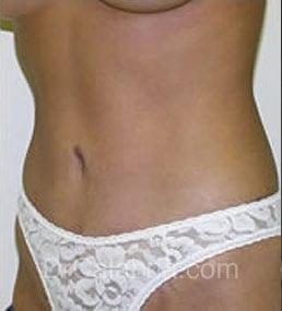 After Image