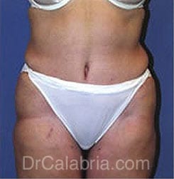 After Image