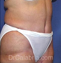 After Image