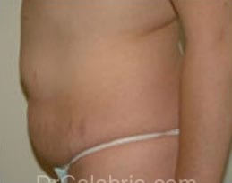 Before Image
