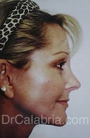 After Image
