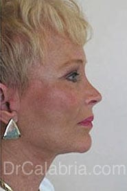 After Image