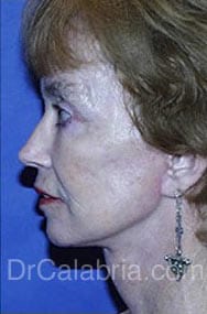 After Image